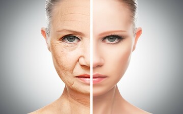 wrinkles reduction bangalore